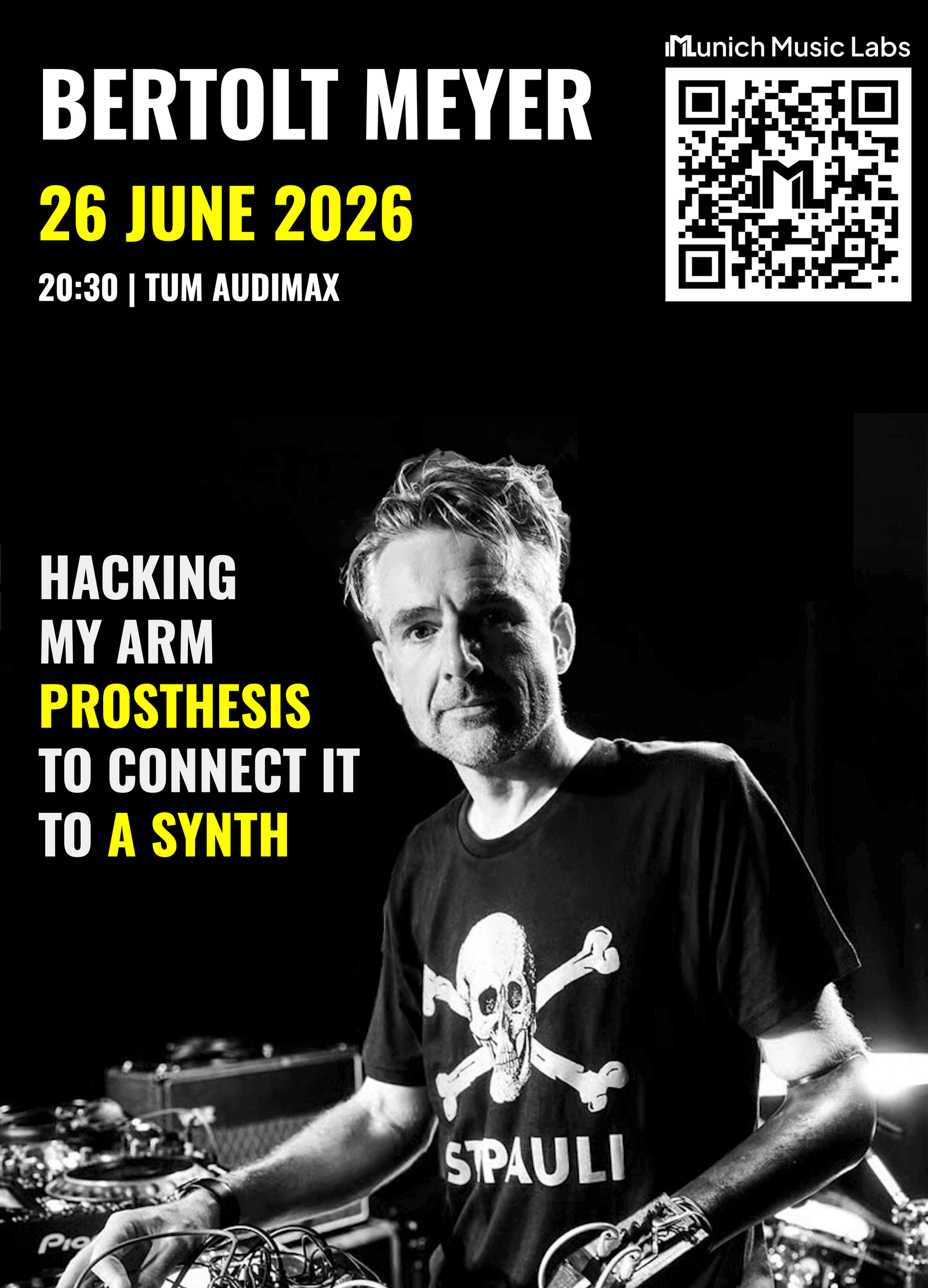 Hacking My Arm Prosthesis to Connect It to a Synth
